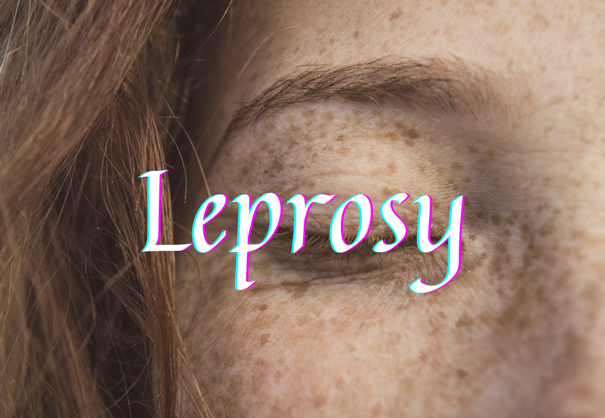 What causes leprosy and is there a cure
