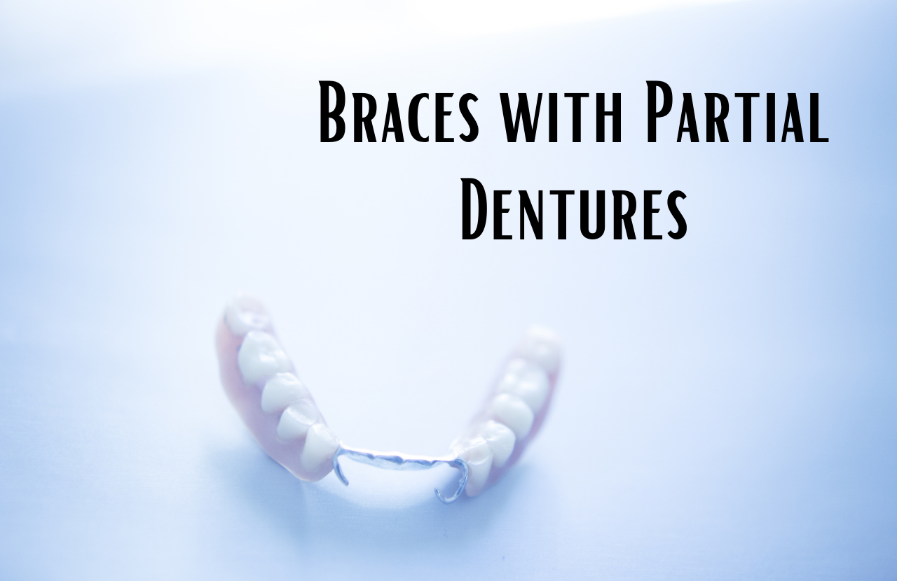 Braces with Partial Dentures