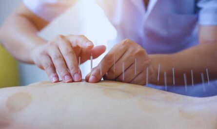 Acupuncture, Health Benefits of Acupuncture